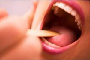 Zmiany patologiczne w obrębie jamy ustnej